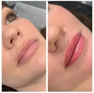 Side-by-side before-and-after pink lip blush treatment showing enhanced lip color, shape and definition by 3D Brows in Utah.